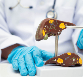Liver Transplant consultation