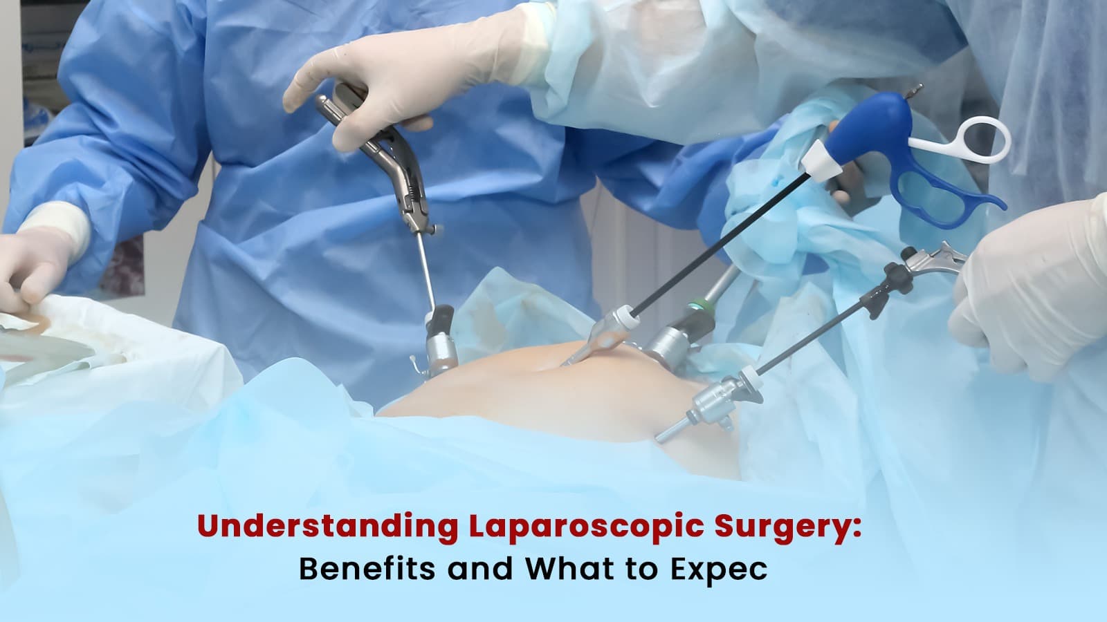 Understanding Laparoscopic Surgery Benefits and What to Expect