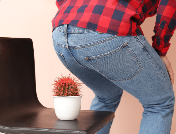 Hemorrhoid Grades